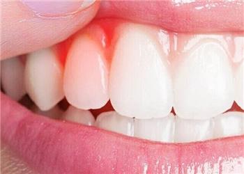 کیفیت خواب ضعیف، رهاورد بیماریهای لثه