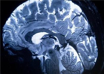 معرفی آخرین یافتههای علوم اعصاب با حمایت ستاد علوم شناختی