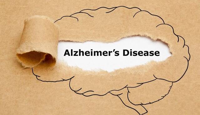 تشخیص آلزایمر با کمک آزمایش ادرار سال‌ها قبل از بروز علائم