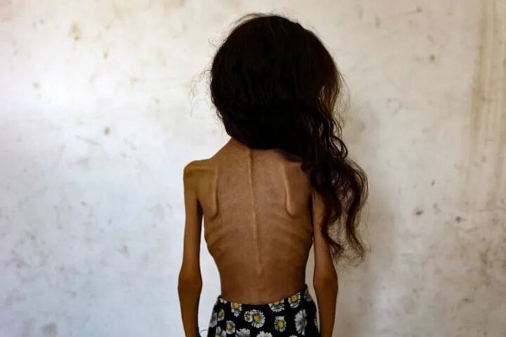 کاریکاتور تلخ نشریه ایتالیایی در واکنش به گرسنگان غزه