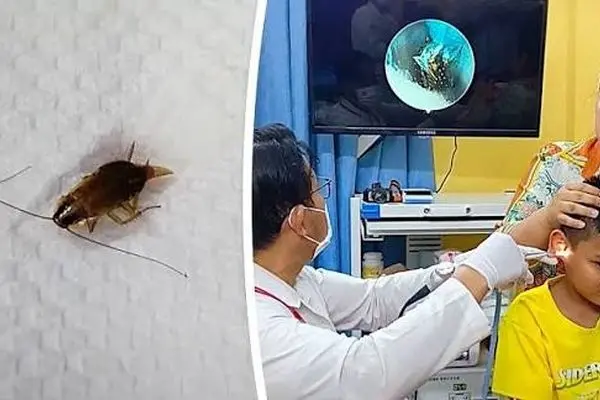 خارج کردن سوسک زنده از گوش یک کودک!