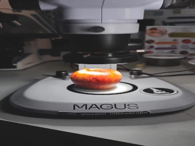 پوست میوه‌ی نشسته، زیر عدسی میکروسکوپ