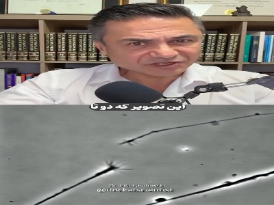 سیم کشی مغز باعث میشه بتونیم با اتفاقات کنار بیایم