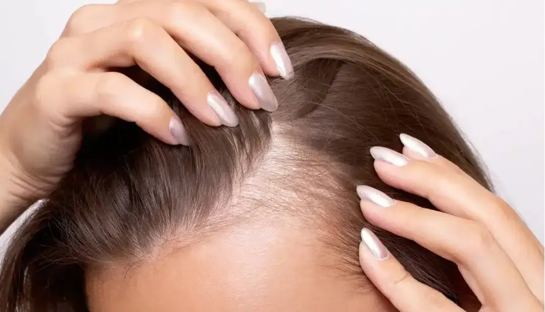 مقصر اصلی ریزش موی ناشی از استرس بالاخره شناسایی شد