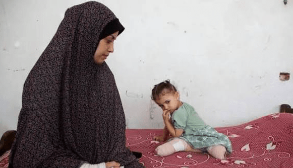 قطع عضو ۶ هزار تن از مردم غزه در جنگ اسرائیل