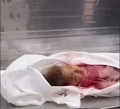 جنایت در غزه ادامه دارد!