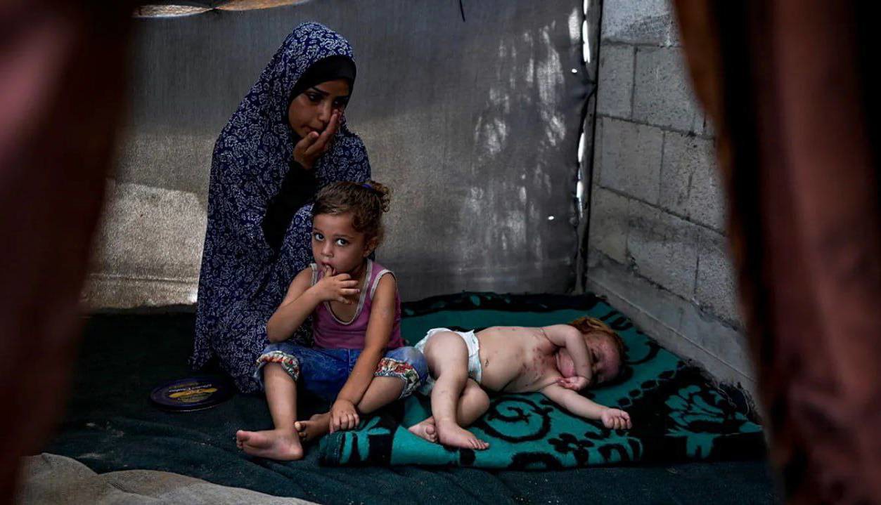 هلال احمر فلسطین: شیوع هپاتیت نوع A در غزه